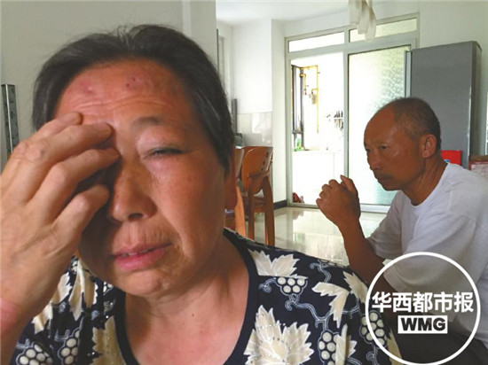 成都大妈在小诊所治皮炎打完针后右眼失明