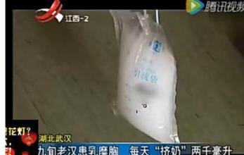 九旬老汉每天“挤奶”4斤，什么是淋巴？