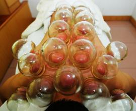 拔火罐起水泡一般是什么原因,拔火罐为什么有的出水泡