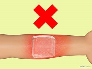 烧伤的急救方法,眼化学烧伤急救