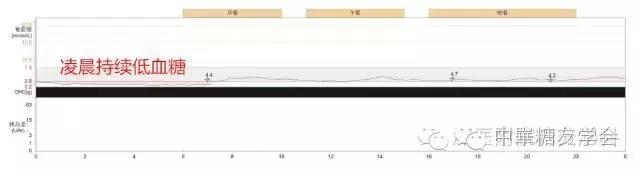 最好最精确的血糖监测仪,监控血糖软件