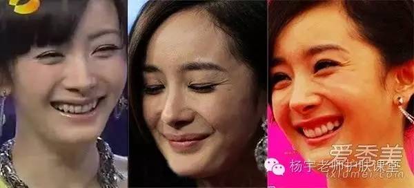 一招搞定松弛面部,脸部防松弛推荐