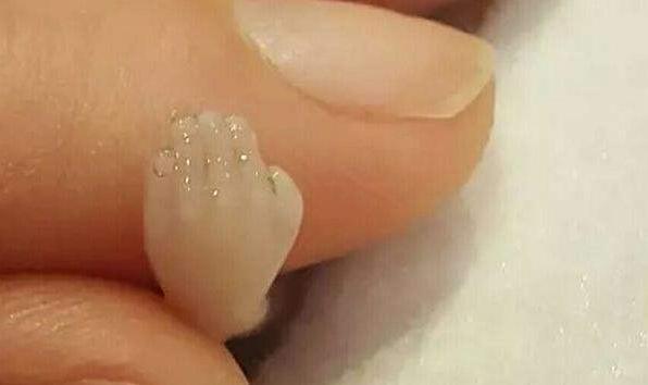 人工流产的胎儿最后去哪了,人工流产胎儿去哪了