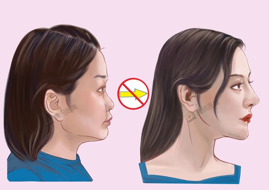 隆鼻的几大风险,隆鼻真的10个做9个后悔吗