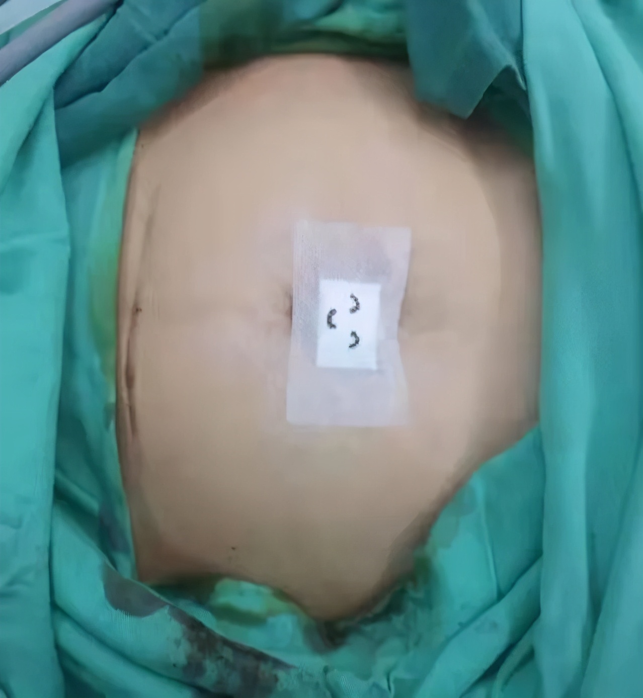 兰州市第一人民医院妇科李红芳,最好的我们医院片段