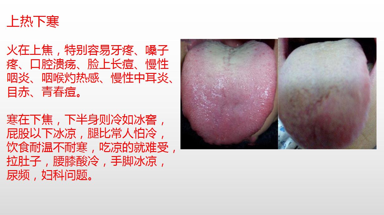 一边上火口腔溃疡，一边怕冷拉肚子手脚冰凉？3招搞定上热下寒