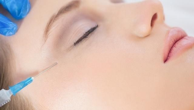 泽佳怎么去除鱼尾纹,30岁眼角纹明显怎么改善