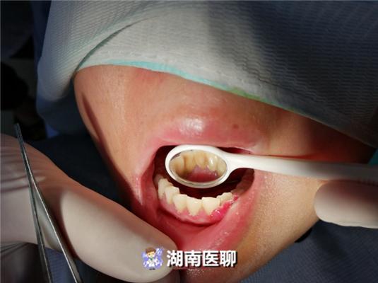 原创科普牙龈有问题孕期莫忽视,孕期牙龈上长了个小肉疙瘩图片