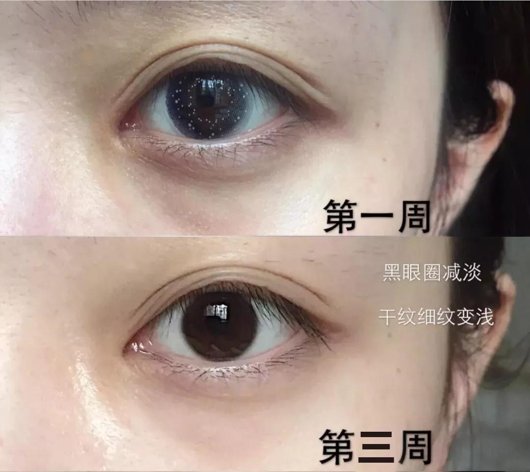 眼霜有必要用好一点的么,眼霜一般有没有用