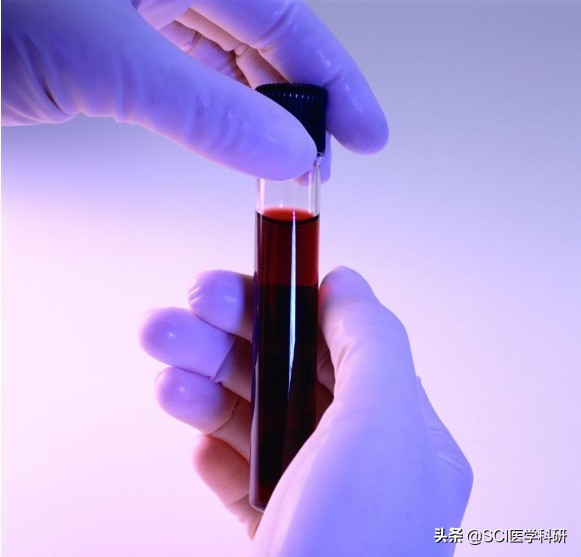 一滴血筛查癌症,一滴血2小时能检查13种癌症吗