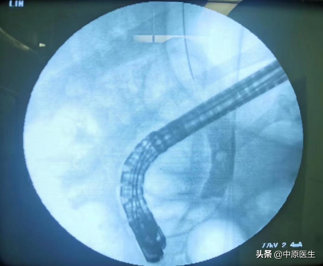 十二指肠与哪个器官对应,与十二指肠相邻的有哪些器官