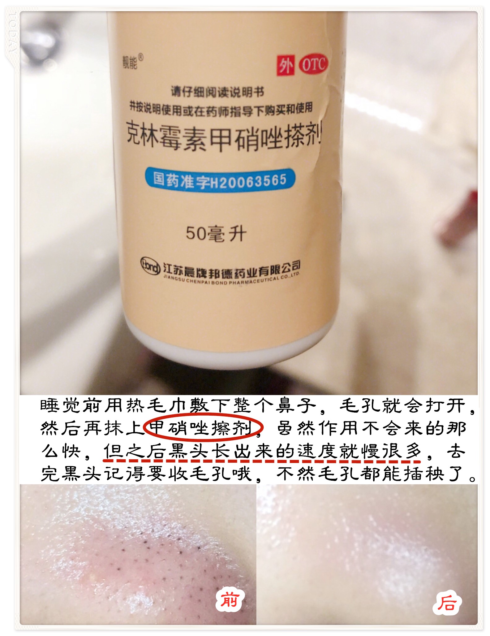 别爱我没结果，除非皮肤好过我，去黑眼圈细纹逆袭漫画眼