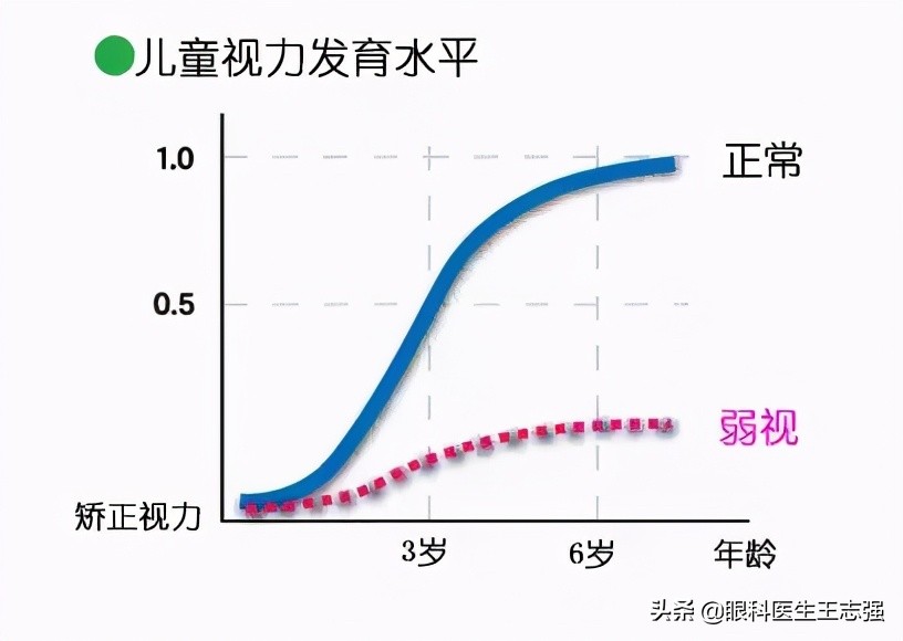 矫正视力1.0表示什么意思,矫正视力达到多少是正常
