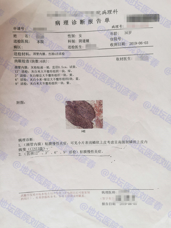 宫颈cin2级未生育怎么治疗最好,宫颈cin1用干扰素有效果吗