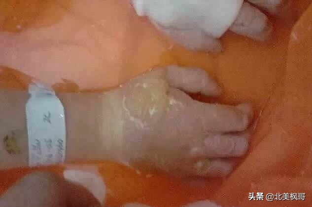 加拿大最危险五大动物,全球十大危险有毒动物