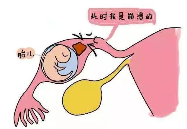 紧急避孕药其实没有那么可怕,紧急避孕药真的危害这么大吗