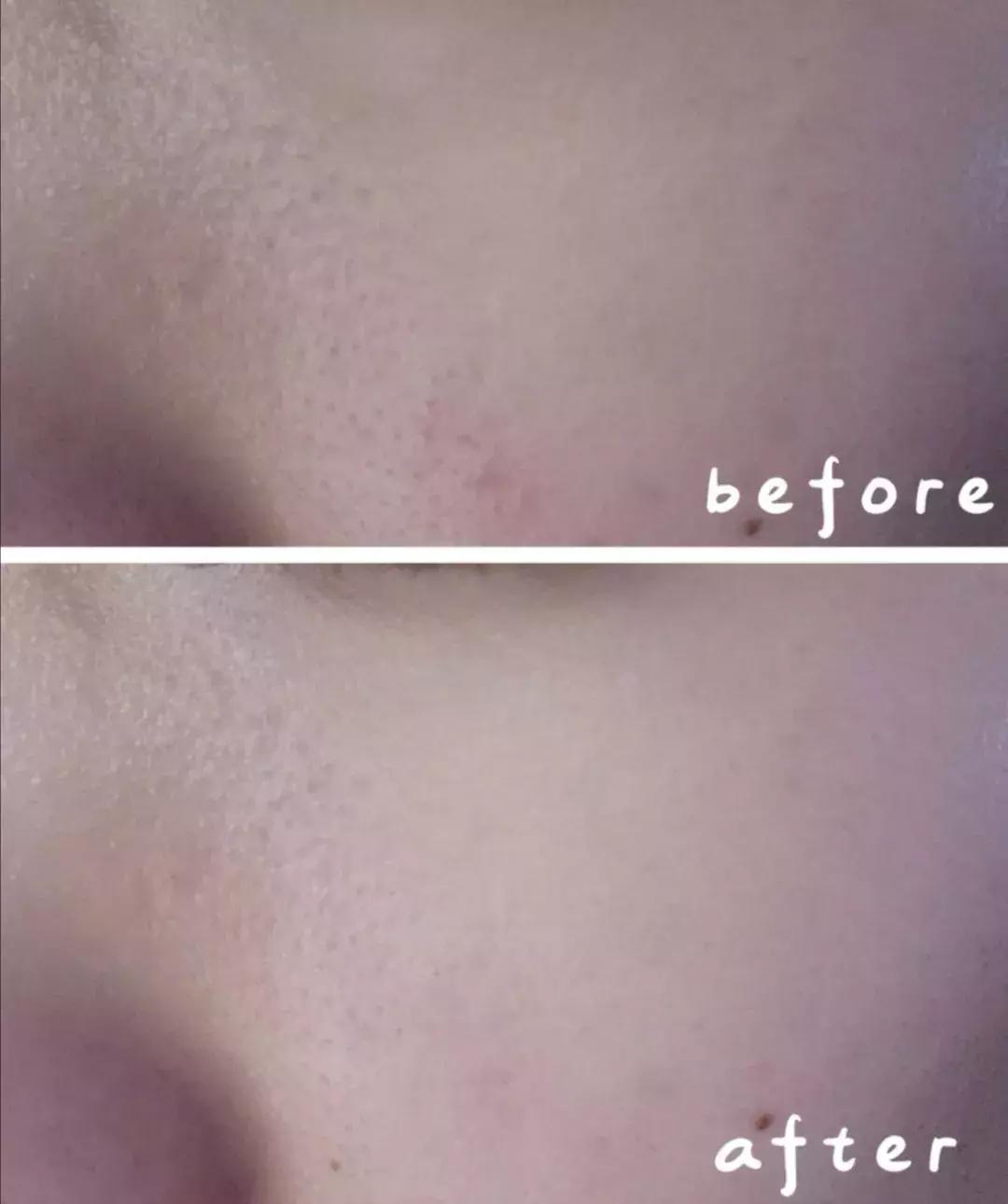 护肤成分合集你懂吗,必须要知道的护肤成分避免踩坑