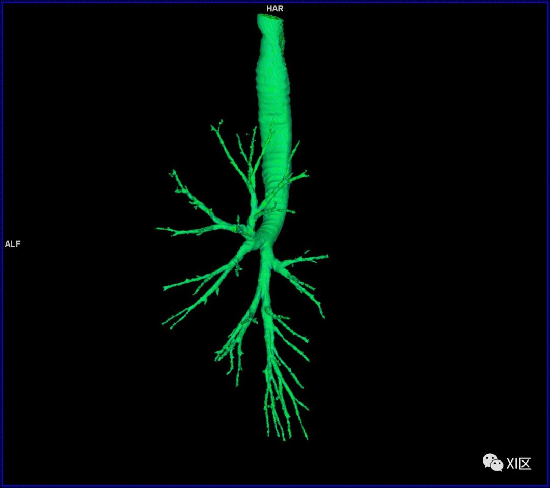 如此详细的肺部影像解剖，有点儿酷！