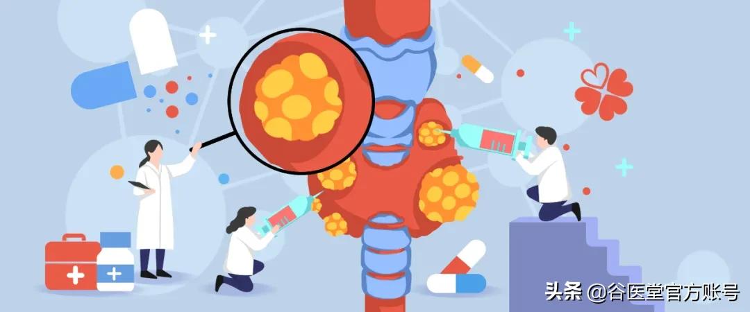 男子甲状腺结节，谷医堂耳鼻喉老中医庞忠红，42天治疗获奇效