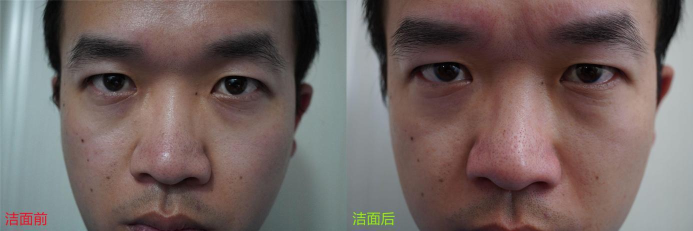 油性皮肤如何补水控油,油性肌肤控油小技巧