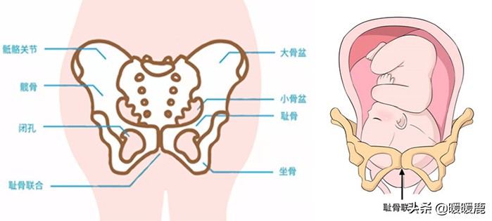 孕妇*处私**骨头痛是耻骨联合分离吗，疼的不能走路，不能翻身怎么办