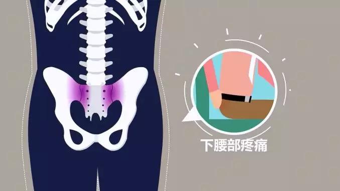 强直性脊柱炎可以做广播体操吗,一起来做广播操