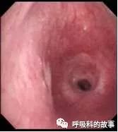 平台型的变化是什么,平台功能有什么新的变化