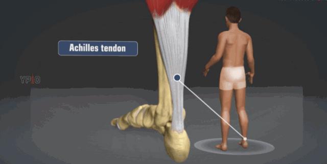 跟腱断裂康复的几个阶段,跟腱断裂手术三周跟腱恢复情况