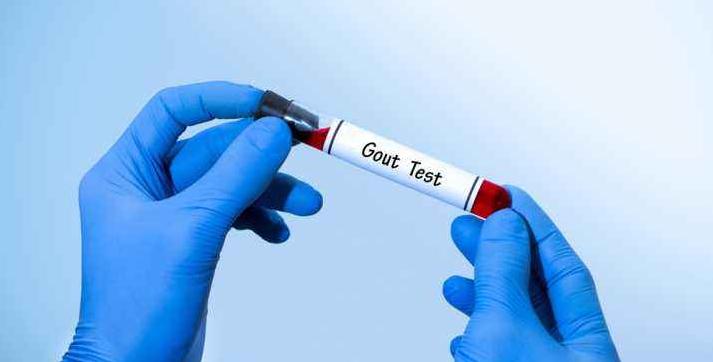 碳酸氢钠和乌鸡白凤丸治痛风吗,碳酸氢钠能治痛风吗