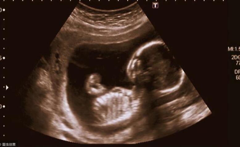 孕晚期36周胎动特别频繁怎么回事,孕晚期做胎监胎动频繁是怎么回事