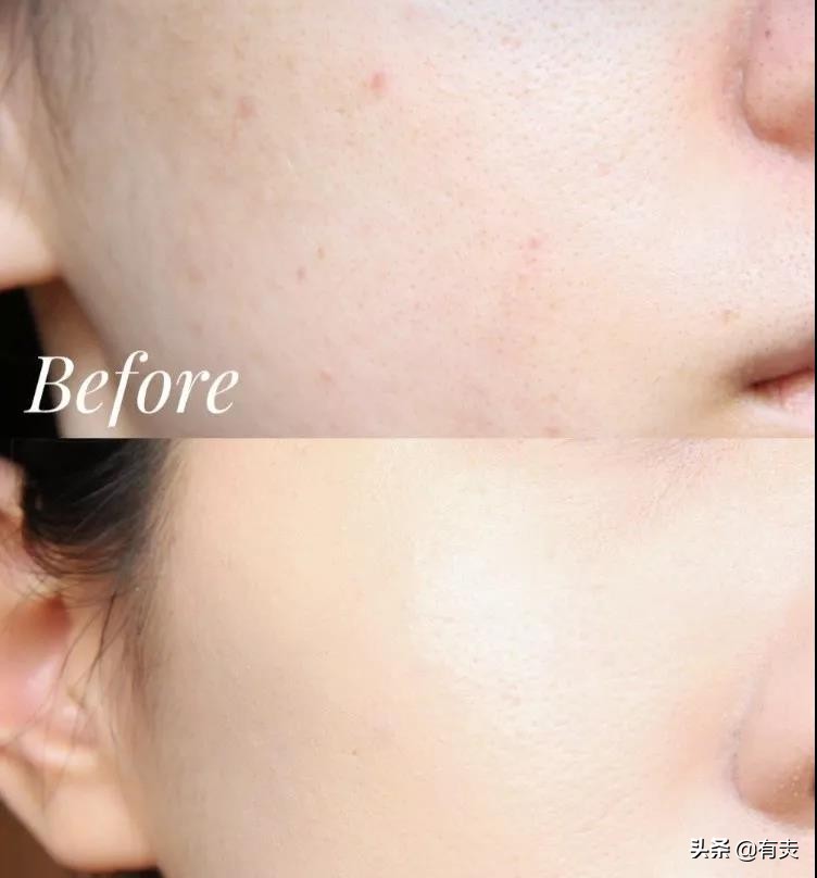 干皮、油皮、痘痘肌看过来!亲测不卡粉、不脱妆的粉底液指南!