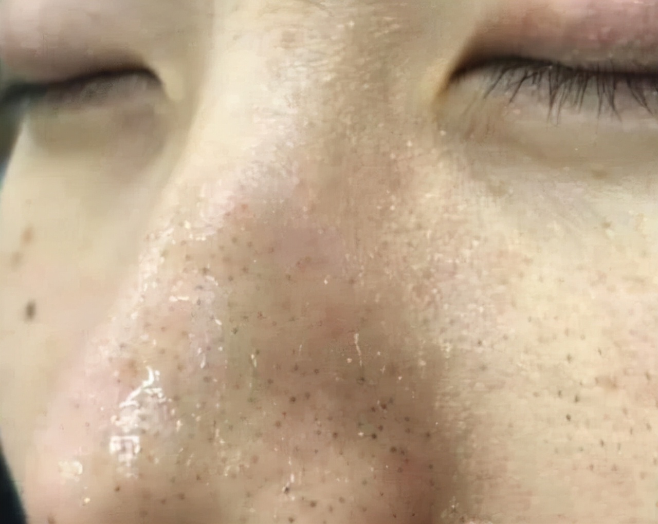 为啥要去脸部角质,为什么要去皮肤上的角质