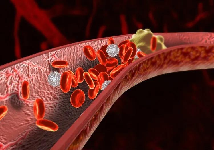 清除血液垃圾打什么针,老年人定期输液对身体好吗