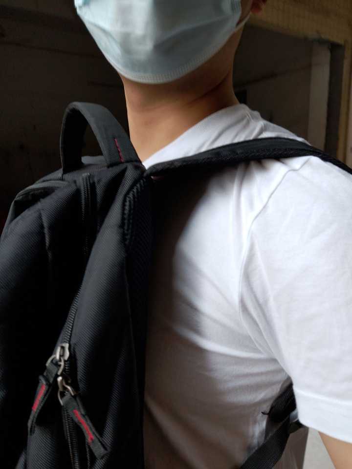 颈椎病要怎么做康复动作,颈椎病常用康复方法是什么