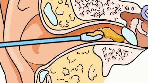 真相孩子为什么要脏着养,宝宝身上脏怎样洗干净