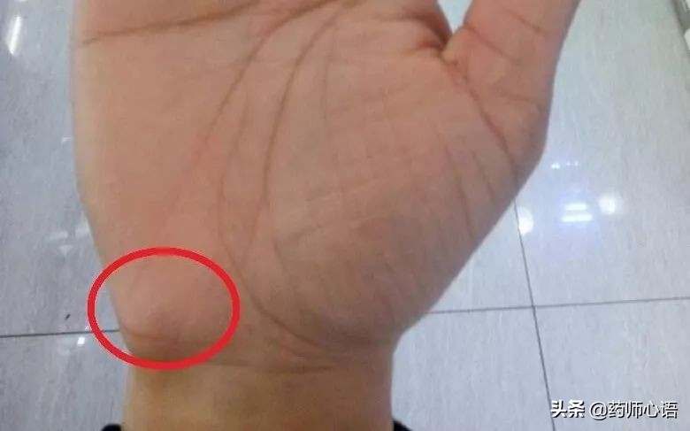 手上的健康秘密,手的颜色能看出健康的问题吗