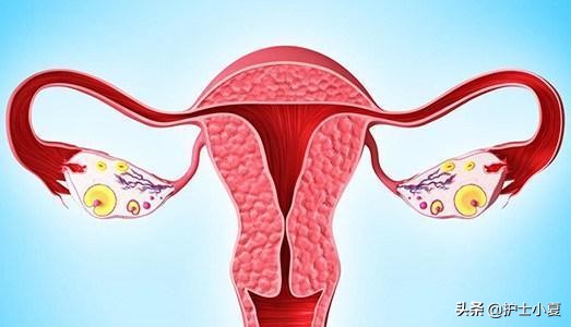 哪些人易患盆腔炎？如何预防与治疗？医生指导您走出误区