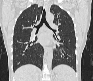 讲解医学影像的书,医学影像学几年