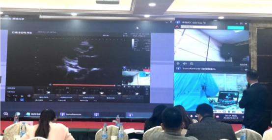 祥生手持超声仪,祥生数字超声仪器