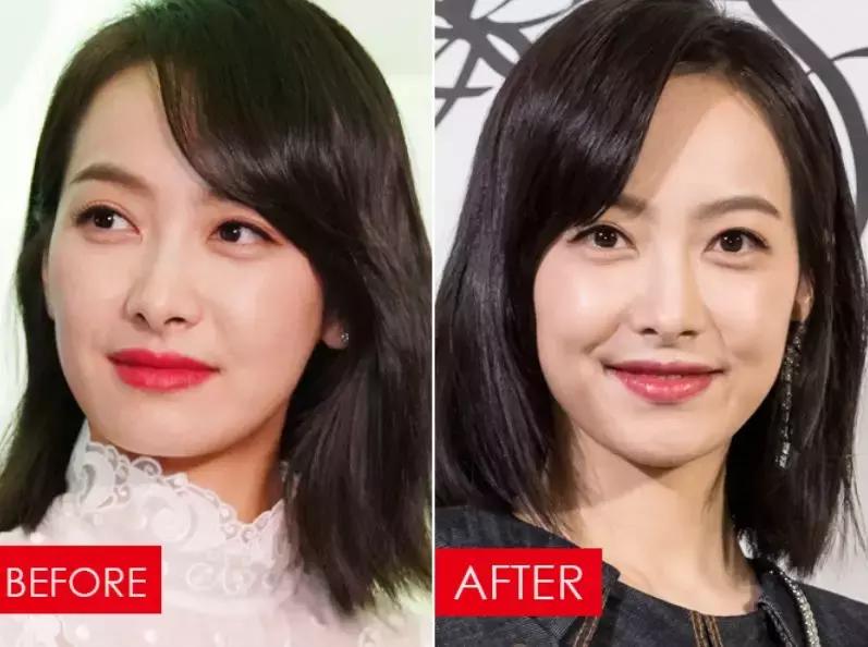 大笑不会长皱纹的方法,大笑没有法令纹