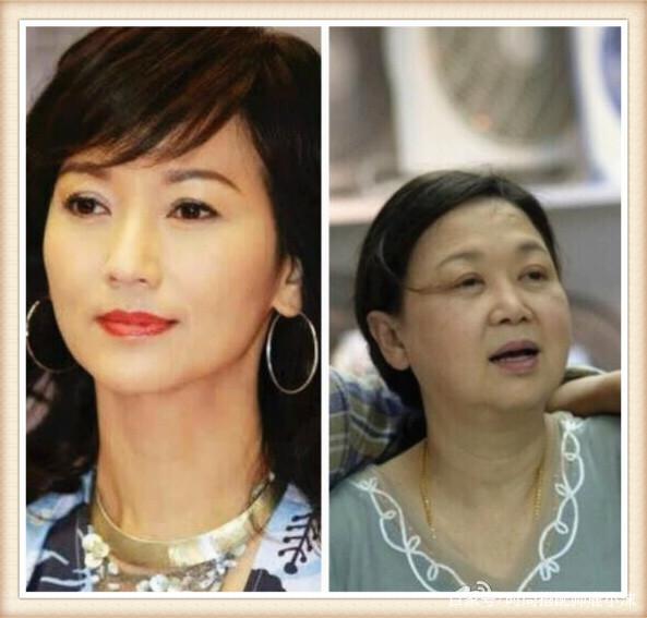 张馨予李佳琦面霜,张馨予李佳琦面膜