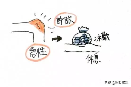 画说小哥哥膝盖疼是怎么回事？