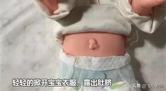 新生儿脐带一个月了还不掉怎么办,新生儿脐带一个多月未脱落