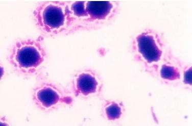 破坏人体生殖系统药物,破坏生育权触犯刑法