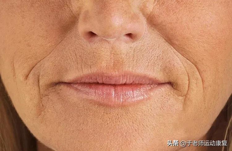 抗皱纹什么办法最好,消除脸上八字纹的方法