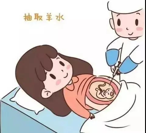 高龄产妇该不该做羊水穿刺,做羊水穿刺多少钱