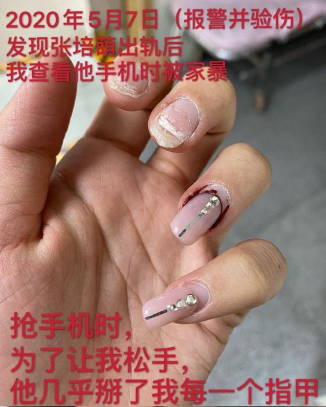 苏炳添说张培萌家暴是真的吗,苏炳添张培萌为什么打岳母