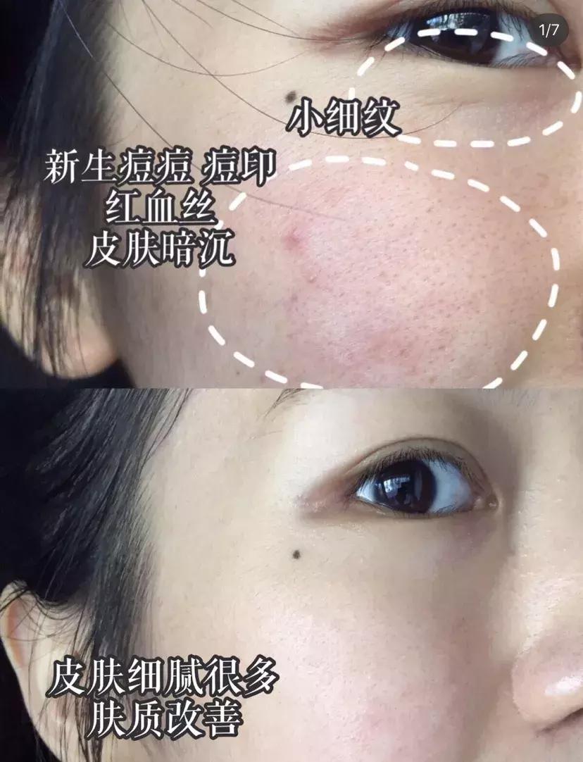 日本这个赛过美白针的王牌内服，让贵妇POLA、SK-II靠边站！