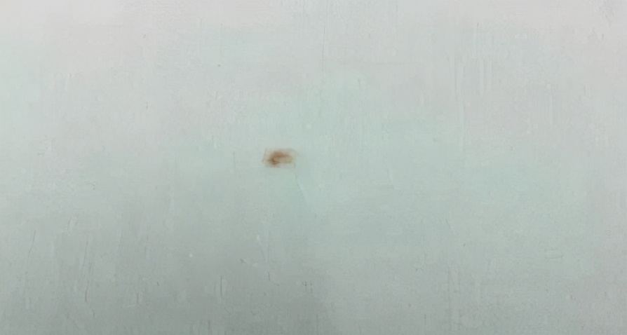 这些都是染色疵病，有图有真相