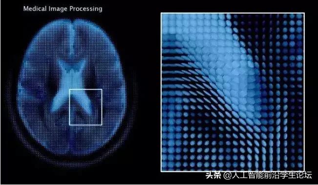 医学影像图像深度学习,医学图像处理专业怎么样